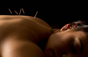 Acupuncture for Pain Relief UK Acupuncture for Pain Relief UK