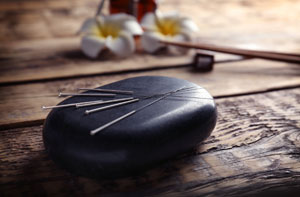 Acupuncture Needles Basildon - Acupuncture Points