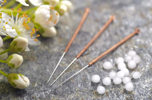 Acupuncture Needles UK - Acupuncture Points Acupuncture Needles UK - Acupuncture Points