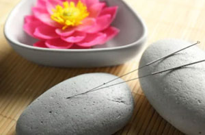 Acupuncture Near Me Exeter