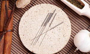 Acupuncture Near Me Basingstoke