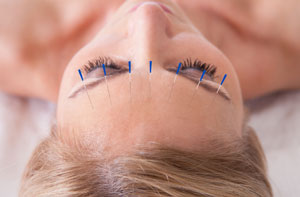 Acupuncturists in Basildon (01268)