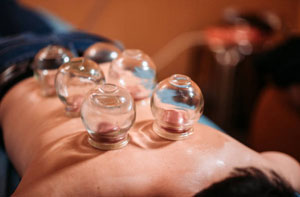 Cupping Therapy Exeter Cupping Therapy Exeter