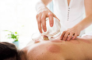 Cupping Therapy Ryde Cupping Therapy Ryde