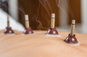 Moxibustion UK (044) Moxibustion UK (044)