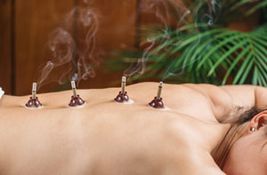 Moxibustion Basildon (01268)